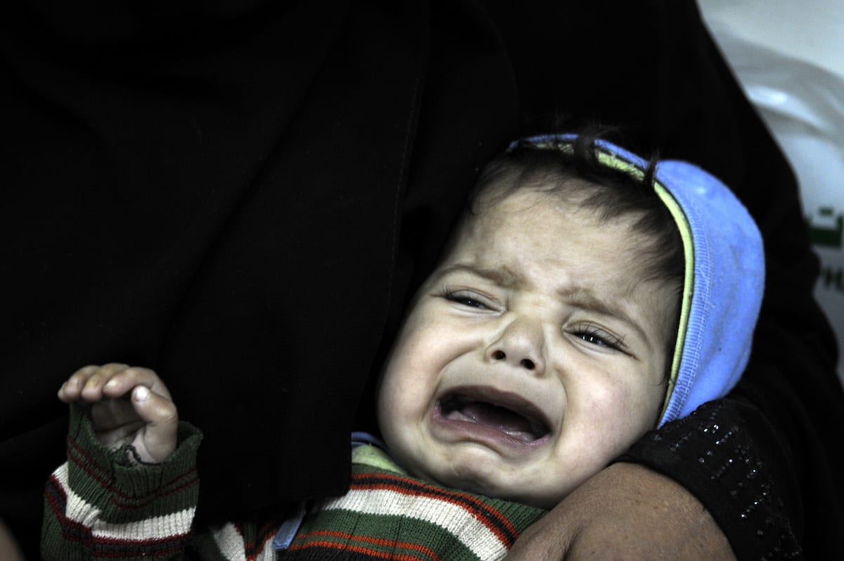 Yemeni child receives treatment at the Sabaeen hospital in Sanaa, Yemen on January 18, 2017 [Mohammed Hamoud/Anadolu Agency]