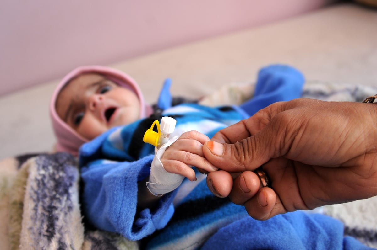 A baby receives treatment at the Sabaeen hospital in Sanaa, Yemen on January 18, 2017 [Mohammed Hamoud/Anadolu Agency]