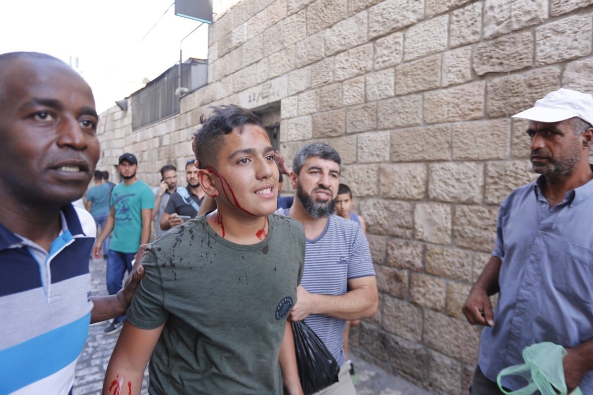 A wounded Palestinian is seen after Israeli forces intervened a protest in front Al-Aqsa compound in Jerusalem on 16 July 2017 [Mostafa Alkharouf/Anadolu Agency ]