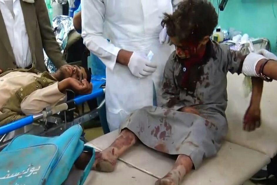 A child receives treatment after a Saudi-led coalition air strike in Yemen on 9 August 2018 [Ansar Allah Media Centre]