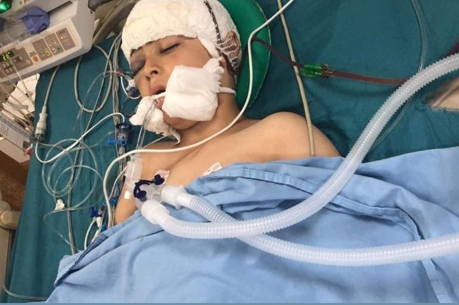 Palestinian child, Abdul Rahman Yasser Shteiwi, 10, was shot in the head by Israeli occupation forces [Twitter]