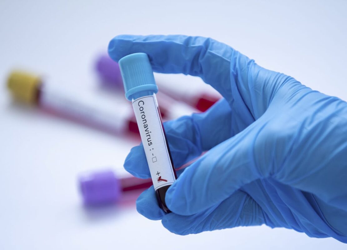 In this photo illustration a coronavirus (2019-nCoV) positive blood sample is displayed on 14 February 2020 in Ankara, Turkey [Aytaç Ünal/Anadolu Agency]