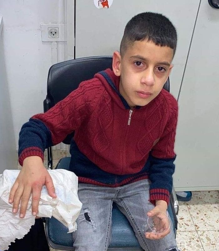 Palestinian child Mohamed Atia was shot by Israeli forces while standing in his schoolyard