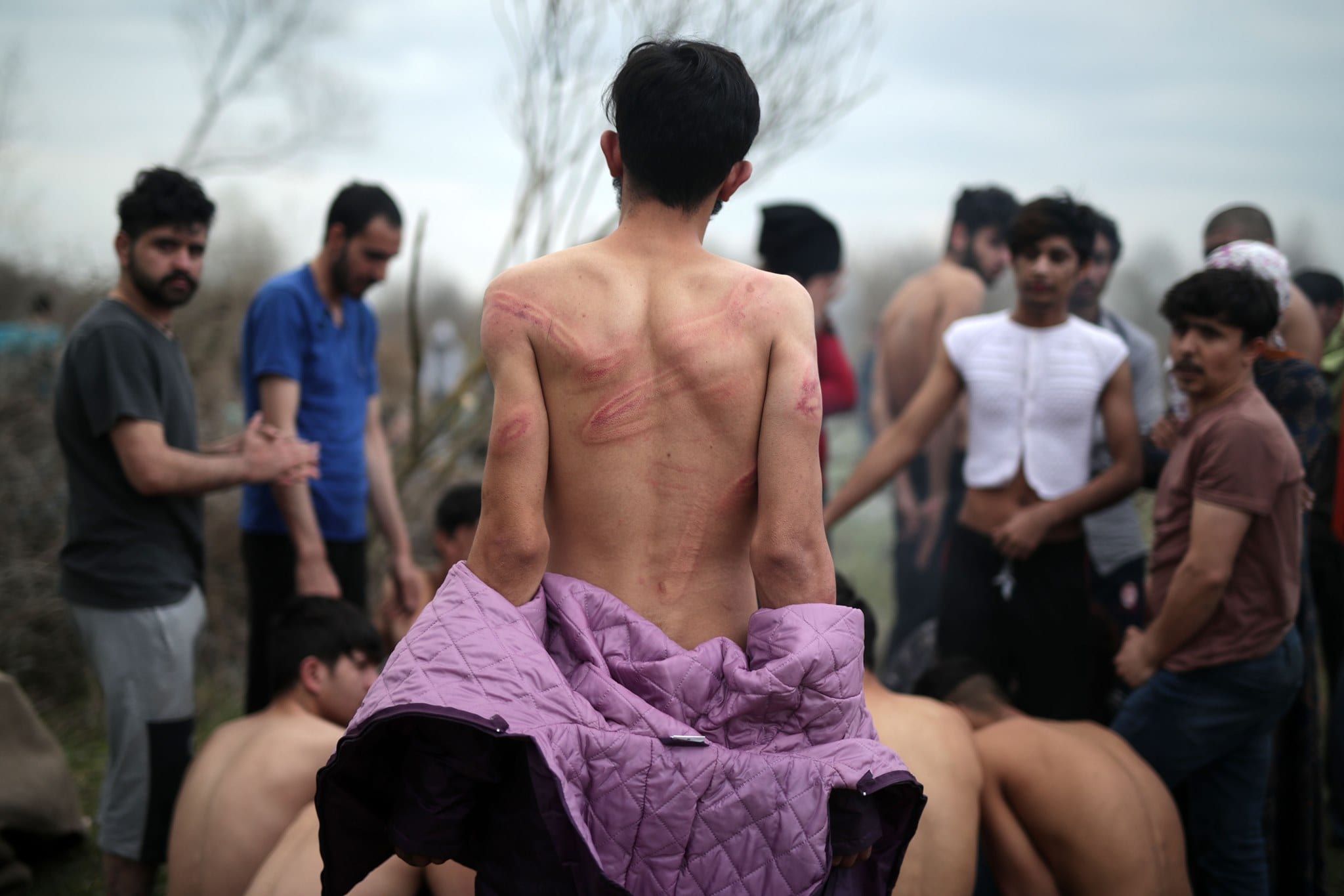 Syrian refugees tortured in Greece [Twitter]