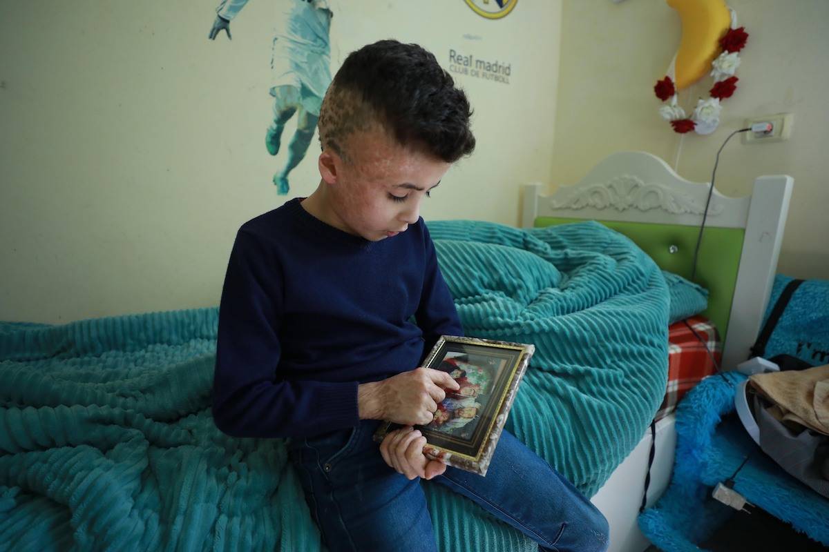 10-year-old Ahmed Dawabsheh whose 60 percent of body burnt during an arson attack by a group of Israeli Jewish settlers to Duma village, shows a family photo partially burnt down at the house in Nablus, West Bank on June 13, 2020. [Issam Rimawi/Anadolu Agency via Getty Images]