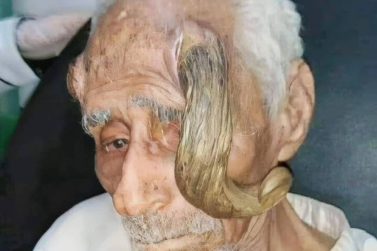 Yemen's Ali Anter died on 12 March 2023 at the age of 140, he is believed to be Yemen's oldest man