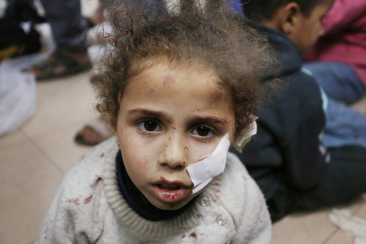 A Palestinian child, heavily injured in an Israeli attack on Nuseirat refugee camp, is seen under treatment at Al Aqsa Martyrs Hospital in Deir al Balah, Gaza on March 05, 2024. [Ashraf Amra - Anadolu Agency]