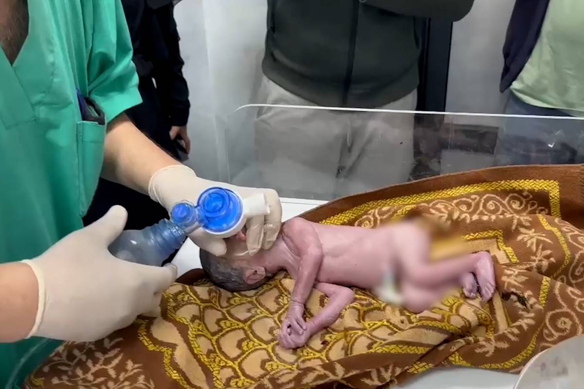 Gaza doctors save unborn baby after mother is killed in Israeli bombing