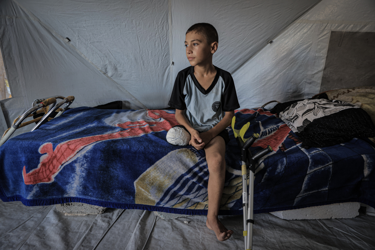 10-year-old Muhammed Omar Selim Muslih, who followed his father to get aid for their family in the Netzarim Corridor was wounded in an Israeli attack and got amputated due to shrapnel injuries, is seen in Gaza City, Gaza on July 08, 2025.[Ahmed Jihad Ibrahim Al-arini - Anadolu Agency]