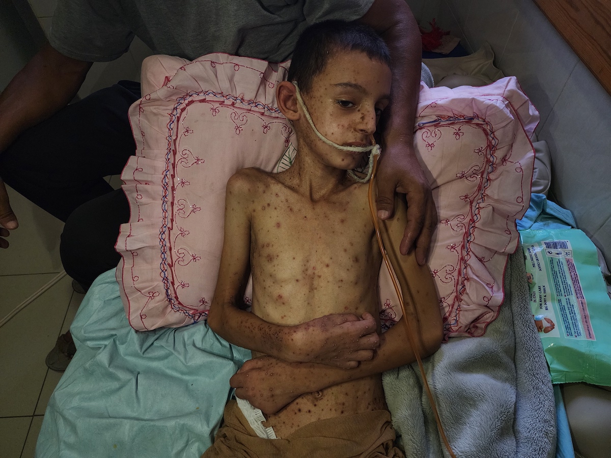 ‘Worst-case scenario of famine’ unfolding in Gaza: IPC report