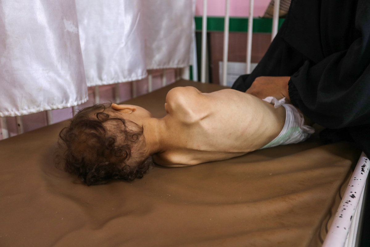 Famine claims 5 more lives in Israel-blockaded Gaza