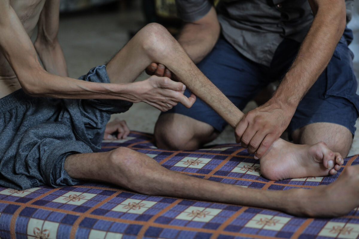 36-year-old Khalil Muhammed Dervis, living in the Nuseirat refugee camp in the central part of the Gaza Strip, which is under Israeli blockade and attacks, struggles with hunger because he cannot access food in Deir al-Balah, Gaza on August 23, 2025. [Hassan Jedi - Anadolu Agency]