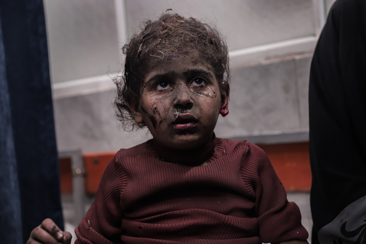 Palestinians killed and injured in an Israeli attack are brought to Al-Shifa Hospital in Gaza City, Gaza on November 19, 2025. [Abood Abu Salama - Anadolu Agency]