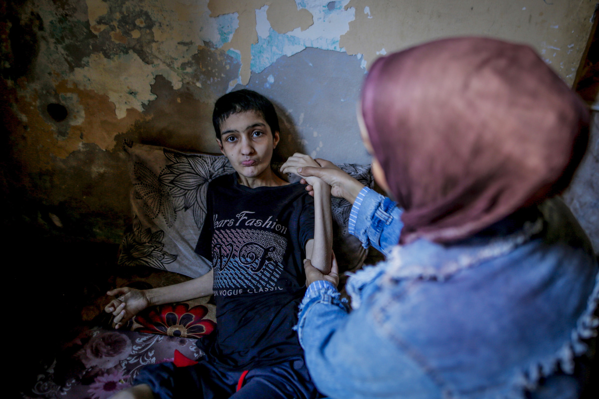 Malnourished Palestinian woman awaits treatment amid Gaza crisis ...